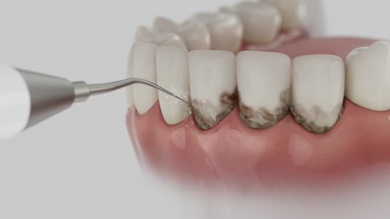 Reliable Dental Implants contractor in Conway, AR by Smile Center Dentistry